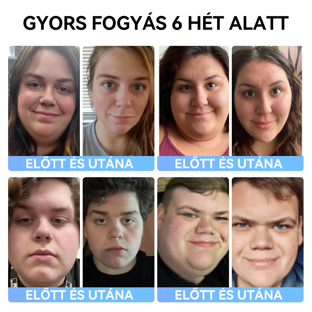 (✅Hivatalos üzlet) 𝑺𝐩𝐳𝐯® 𝐌𝐞𝐠𝐥𝐮𝐭𝐢𝐝 orális oldat💧 (zsírégető élelmiszer, amelyet a Semmelweis Egyetem Orvostudományi Karán fejlesztettek ki)